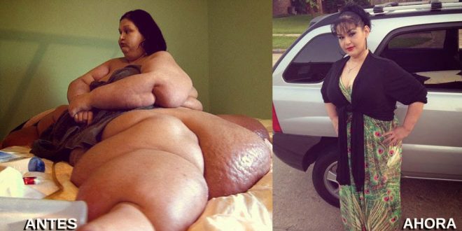 Fue la mujer más gorda del mundo, pero ya bajó más de 400 kilos – El Ojo Web